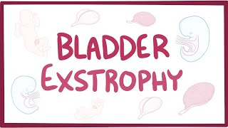 Bladder exstrophy - causes, symptoms, diagnosis, treatment, pathology