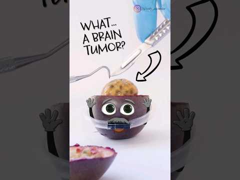 Passion Fruitsurgery - Removing a BRAIN TUMOR ends BAD😱🧠 -  #animation #foodsurgery #brain