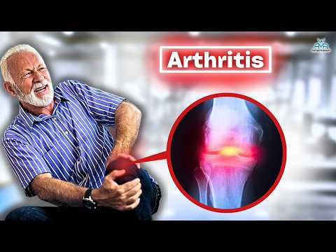 The BEST Knee Osteoarthritis Rehab Exercises!