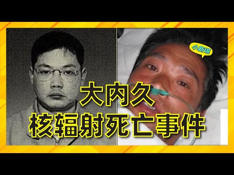 日本大内久核辐射死亡事件：全身DNA断裂，皮肤脱落，体液渗出 #大内久 #核辐射 #东海村JCO临界事故