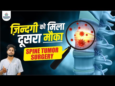 Spine Tumor Surgery Success | Neurosurgery | Healing Hospital Chandigarh