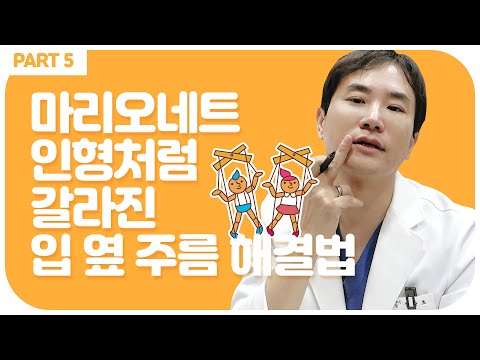 마리오네트리프팅 마리오넷주름? 입가주름? 어렵지않아요!