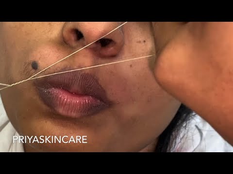 Upper lip threading ( tutorial ) | How to do remove,upper lip threading🧵||Step by step (Hindi)