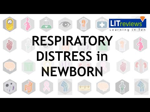 Respiratory Distress Syndrome in Newborn - Duke University