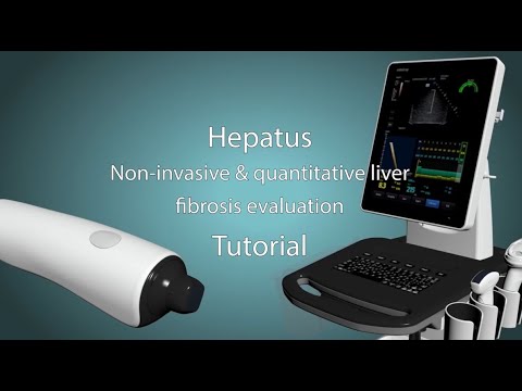 Hepatus 6 Ultrasound Operational Video