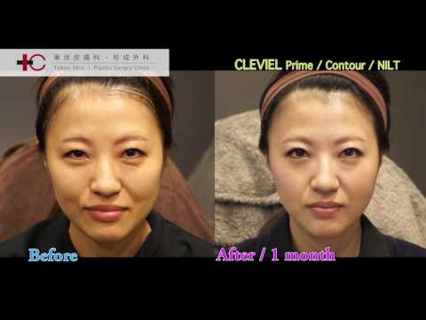 CLEVIEL prime/contour /美容外科 / 美容整形 / アンチエイジング