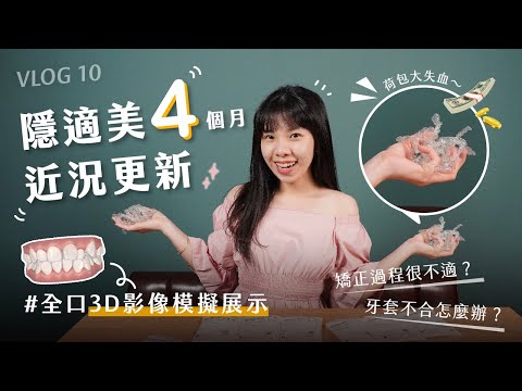 【ET’s Vlog #10】隱適美配戴4個月紀錄---矯正過程很不適? 牙套不合怎麼辦? 用全口3D圖來看牙齒的變化!