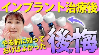 インプラント治療後に後悔！？実は無くなっている歯の超重要機能