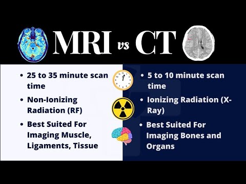 MRI vs CT Scan (What’s the Difference?) Radiation, Cancer, Imaging Methods, and More!