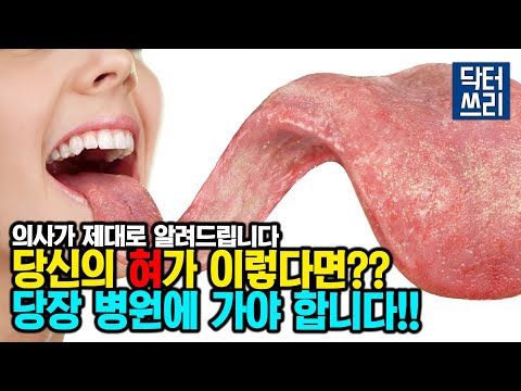 지금 당장 거울 앞에 서서 혀와 눈썹을 확인하세요!! 여러분의 인생이 바뀔 수 있습니다 [Engine 1편]