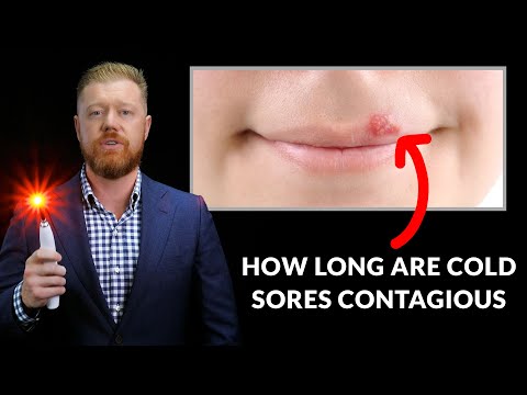 How Long Are Cold Sores Contagious?