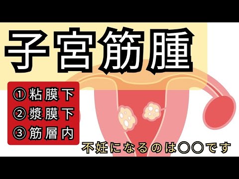 【重要】子宮筋腫があると《妊娠出来ない》と思っていました、、、妊娠率は◯◯%です