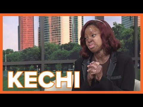 Kechi Okwuchi on her memoir, "More Than My Scars"