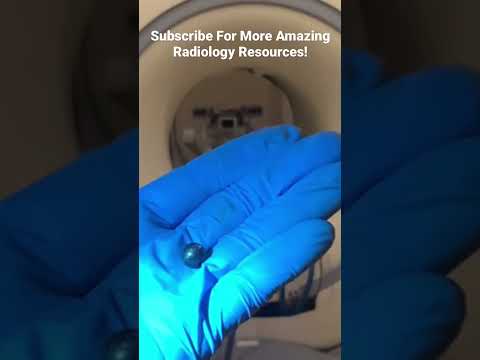 Metal in MRI removal process- taking an MRI Apart