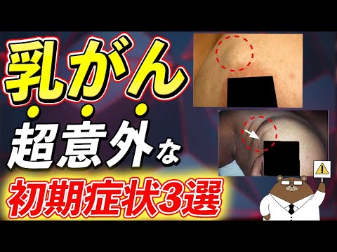 放置厳禁！絶対に見逃さないで！知らないと後悔する乳がんの危険サインとは？予防法は存在するの？