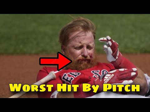 MLB | Cracks Hit By Pitch