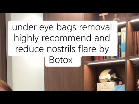 How to Remove Eye Bags Permanently (Advice from a Surgeon)