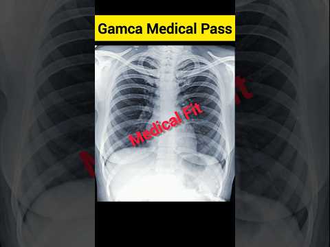 Gamca Medical Fit Part-2