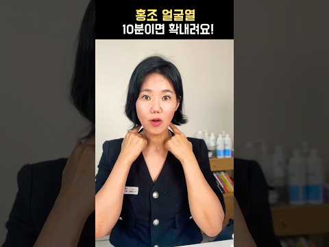 홍조 얼굴열 10분만에 확내려요