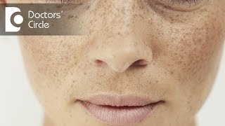 What is Pigmentation and how can you treat it? - Dr. Aruna Prasad