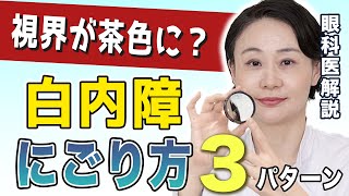 白内障のにごり方３パターンの特徴とは？症状に気付きにくい…眼科医の白内障解説【その④】