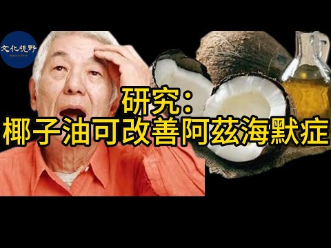 【健康】研究：椰子油可改善阿茲海默症【文化視野】