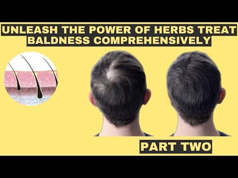 Secrets of Herbal Hair Restoration Say Goodbye to Baldness