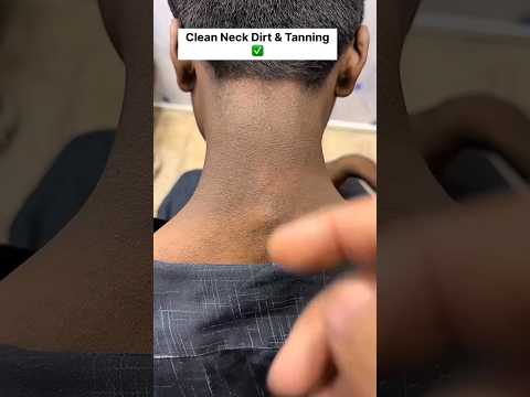 Dark Neck Home Remedies | Neck Cleaning Tips/Easy Neck Tanning Removal Pack #dark #skincare #shorts