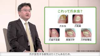 医師からのメッセージ 第１回 爪水虫とは