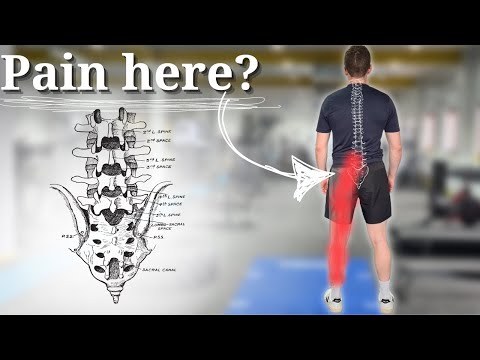 Sciatica Survival Guide: Exercises, Relief, and Warning Signs!