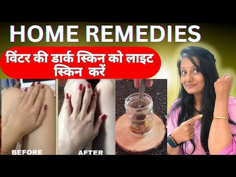 winter ki dark skin ko light skin Karen||DIY winter skin lightening home remedy||Auro's Beauty Care