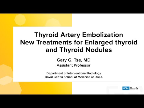 Thyroid Artery Embolization: New treatments for enlarged thyroid and thyroid nodules | UCLA Health