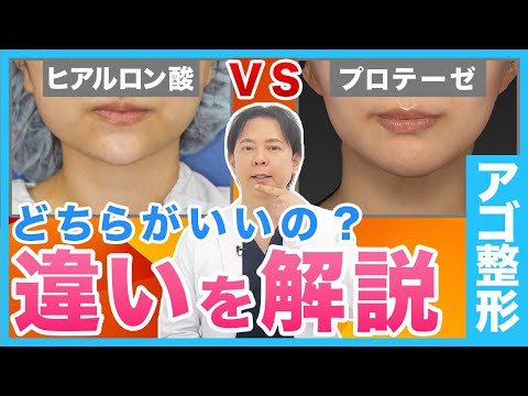 アゴの形を整えるならヒアルロン酸とプロテーゼどちらを選ぶべきか徹底解説