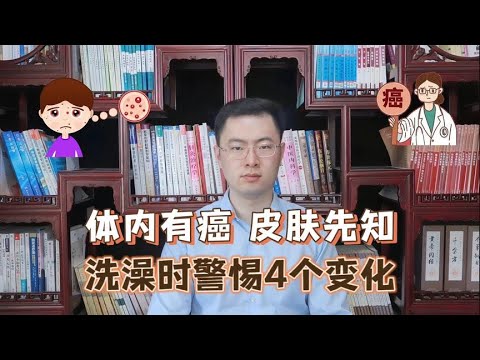 身体有癌，皮肤先知？提醒：皮肤出现4种异常，或是癌症信号【梁怡璋医生】