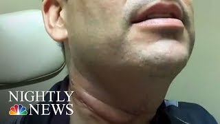 Study Shows 11 Million Men Are Infected With Cancer-Linked HPV And Don't Know It | NBC Nightly News