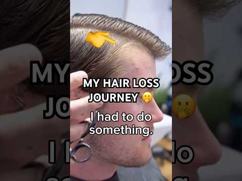 Best hair loss transformation??