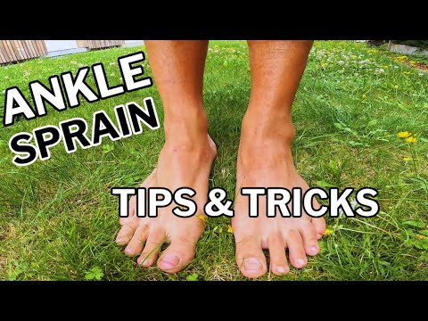 Running with a Sprained Ankle: Tips and Tricks