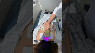 Physiotherapy Laser for Back Pain Combined with Electrical Muscle Stimulation