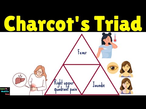 Charcot's Triad | Charcot's Cholangitis Triad Explained