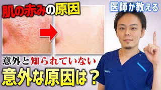 【肌の赤みを消す方法】意外と知られていない肌の赤みの原因を医師が解説！！