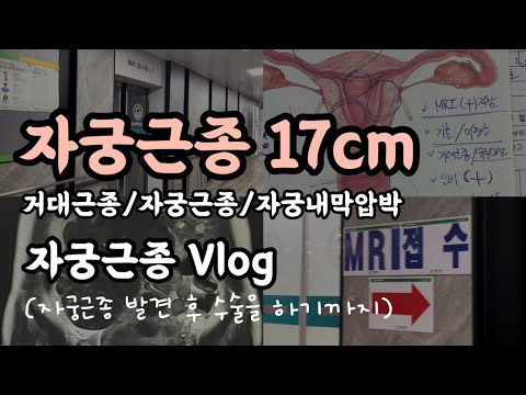 자궁근종수술 / 자궁근종개복수술 / 자궁근종로봇수술 / 자궁근종수술브이로그 / 자궁근종 / 자궁근종증상 / 자궁근종 아랫배 / 자궁근종임신