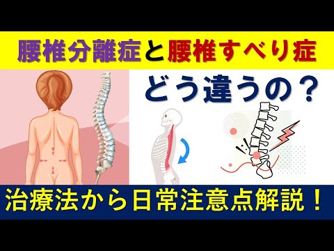 腰椎分離症と腰椎すべり症の違いとは？治療法から日常の注意点まで徹底解説！