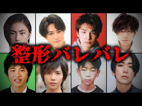 【バレバレ】整形をしている男性芸能人TOP10