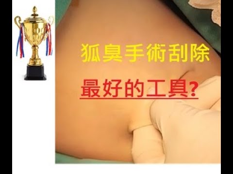 狐臭小教室- 第二十二堂 :  狐臭手術刮除最好的方法是甚麼?