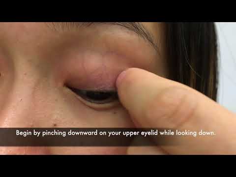 Dry Eye Treatment