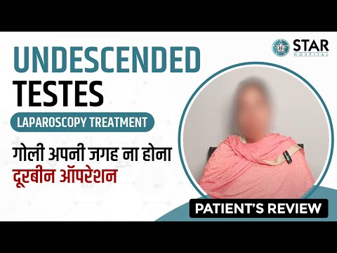 Ectopic Undescended Testis  Laparoscopic Surgery in Kapurthala | गोली अपनी जगह ना होना दूरबीन ऑपरेशन