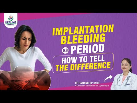 Implantation Bleeding vs Period | How to tell the difference