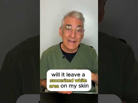 3 Things to Ask Your Dermatologist Before Getting Something Removed!