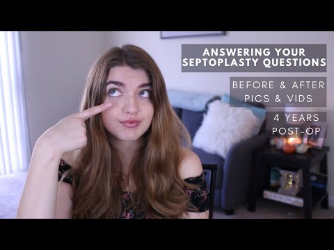 Answering Your Questions About my Septoplasty Surgery