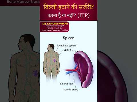 Spleenectomy in ITP | तिल्ली हटाने की सर्जरी? करना है या नहीं ? (ITP)#itp #platelets  #spleenectomy